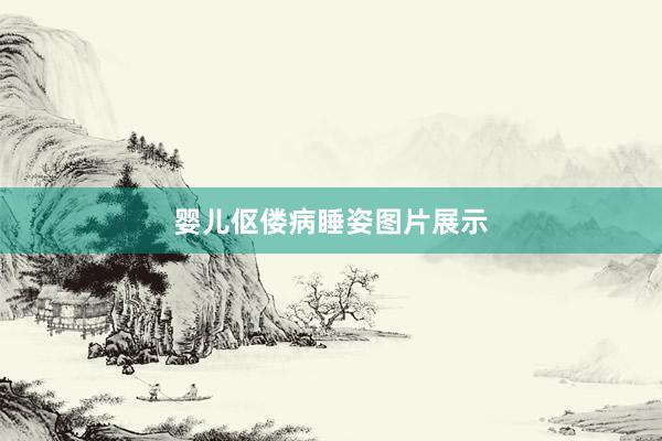 婴儿伛偻病睡姿图片展示